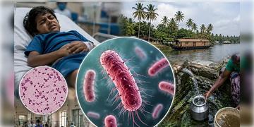 Read more about - Shigella | দেশে থাবা ’শিগেলা’র! মৃত্যু ৪ বছরের শিশুর! গোটা রাজ্য জুড়ে জারি হাই-অ্যালার্ট!